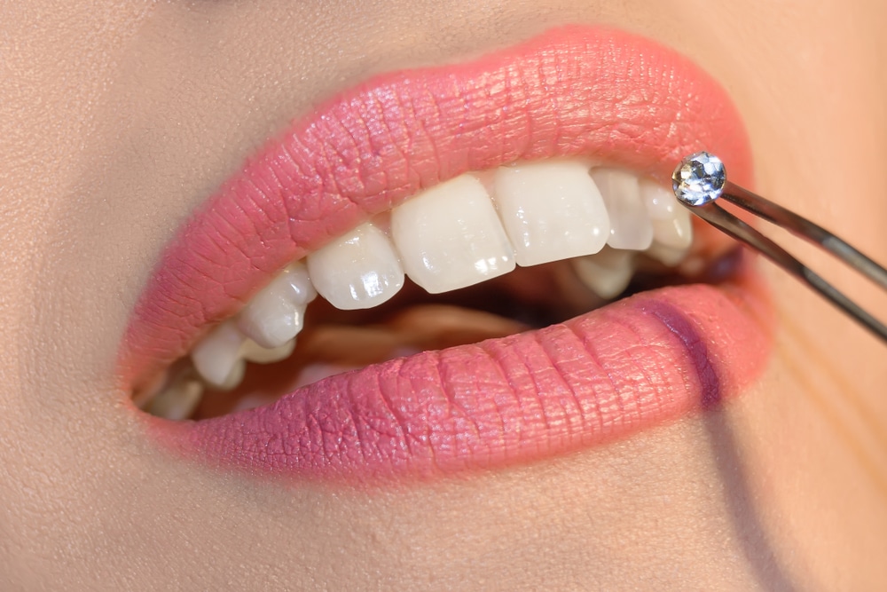 Style Diamant - Bijoux dentaires